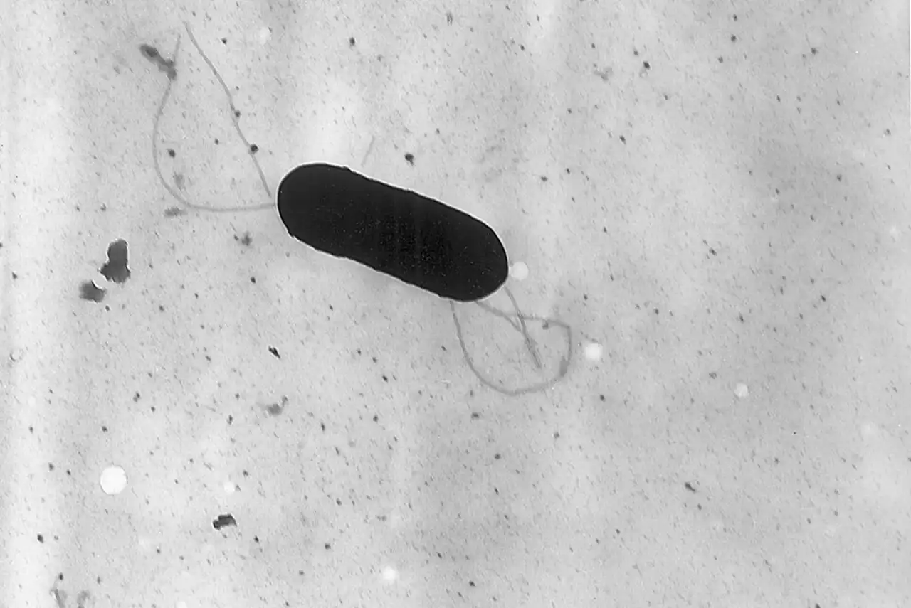 el brote de listeriosis