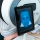 en el rostro señales de mortalidad en cáncer